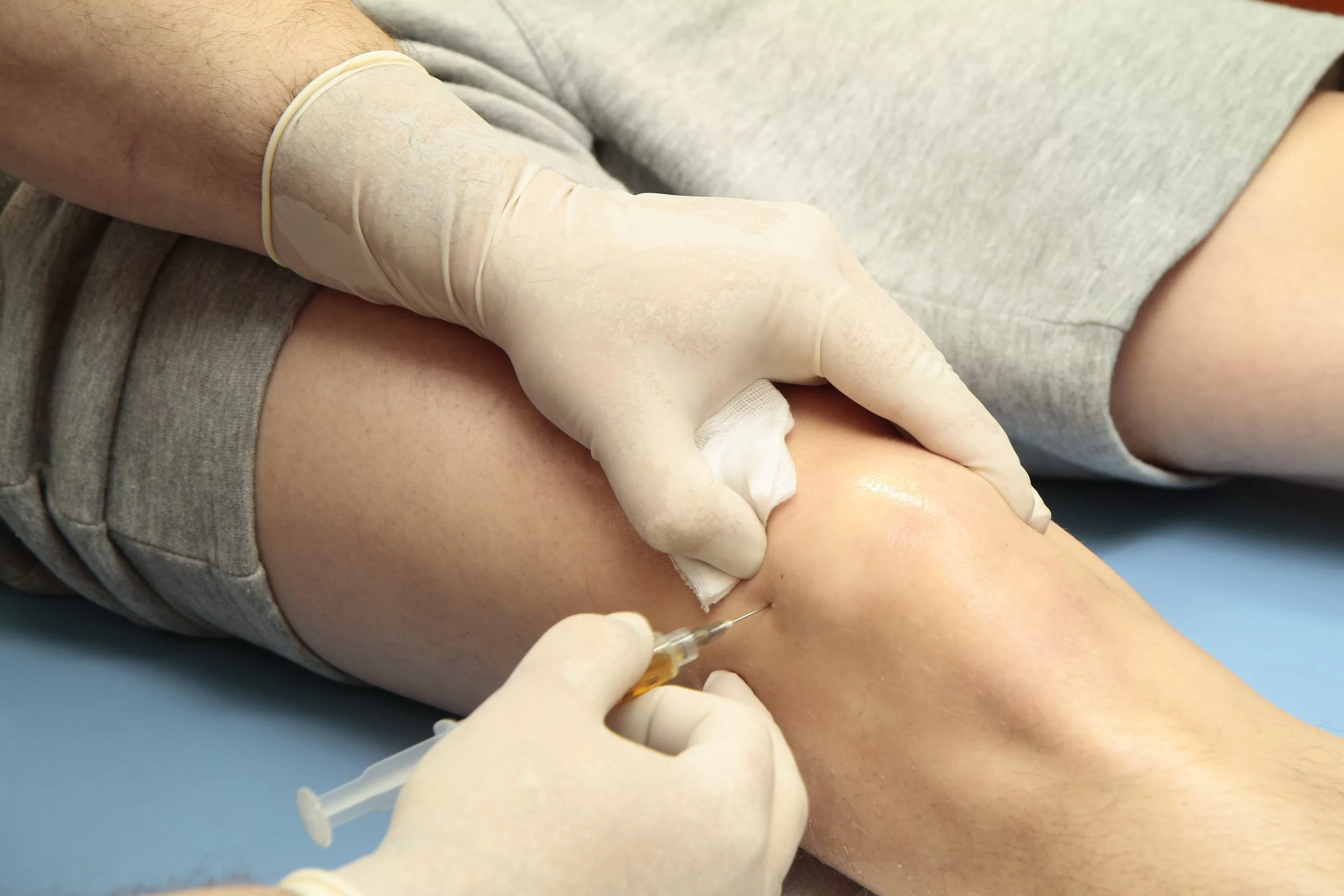 BMC Injection for AVN
